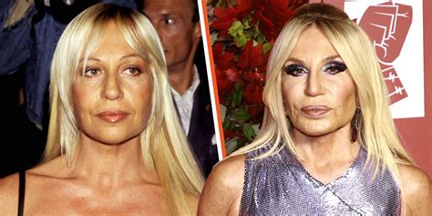 donatella versace before surgery|How Donatella Versace Would Look At 68 If She .